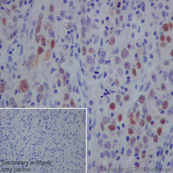 Immunohistochemistry (Formalin/PFA-fixed paraffin-embedded sections) - Anti-SAGE1 antibody [EPR21747] (AB233388)