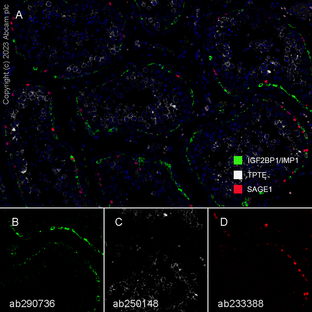 Multiplex immunohistochemistry - Anti-SAGE1 antibody [EPR21747] (AB233388), expandable thumbnail