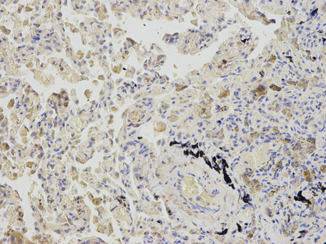 Immunohistochemistry (Formalin/PFA-fixed paraffin-embedded sections) - Anti-SAHH antibody (AB187518), expandable thumbnail