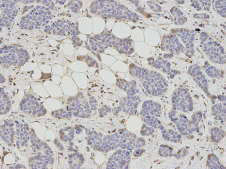 Immunohistochemistry (Formalin/PFA-fixed paraffin-embedded sections) - Anti-SAHH antibody (AB187518)