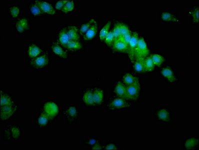 Immunocytochemistry/ Immunofluorescence - Anti-SAHH antibody (AB236110), expandable thumbnail