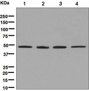 Western blot - Anti-SAHH antibody [EPR9261] (AB134966), expandable thumbnail