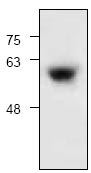 Western blot - Anti-Salivary alpha amylase antibody (AB119493), expandable thumbnail
