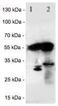Western blot - Anti-Salivary alpha amylase antibody (AB125230), expandable thumbnail