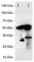 Western blot - Anti-Salivary alpha amylase antibody (AB125230)