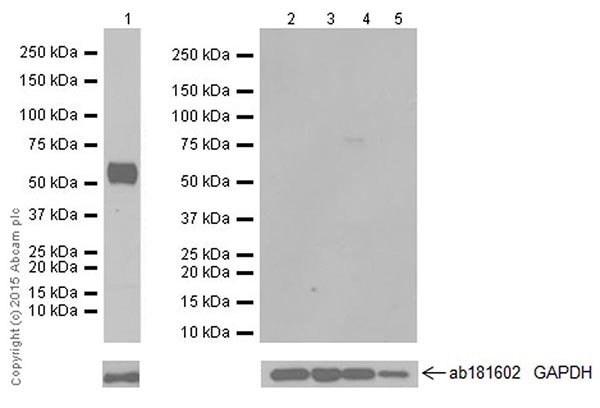 Western blot - Anti-Salivary alpha amylase antibody [EPR18070] (AB209401), expandable thumbnail