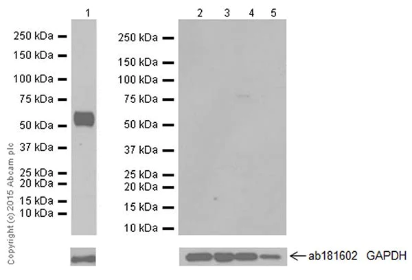 Western blot - Anti-Salivary alpha amylase antibody [EPR18070] (AB209401)