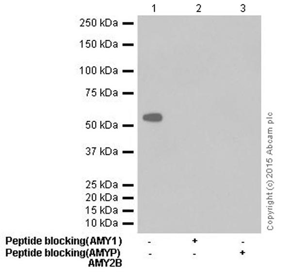 Western blot - Anti-Salivary alpha amylase antibody [EPR18070] (AB209401), expandable thumbnail