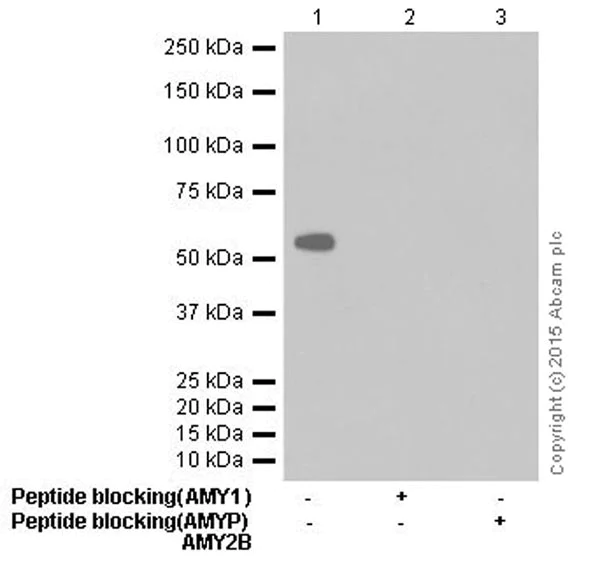 Western blot - Anti-Salivary alpha amylase antibody [EPR18070] (AB209401)