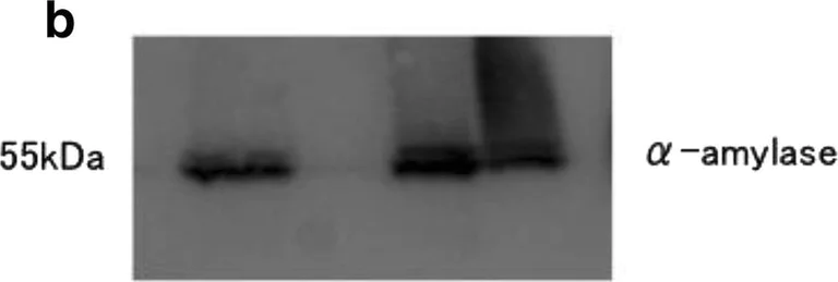 Western blot - Anti-Salivary alpha amylase antibody [EPR19605] (AB201450)