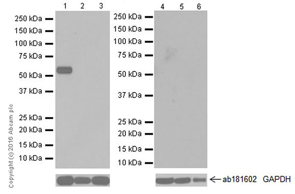 Western blot - Anti-Salivary alpha amylase antibody [EPR19605] (AB201450), expandable thumbnail