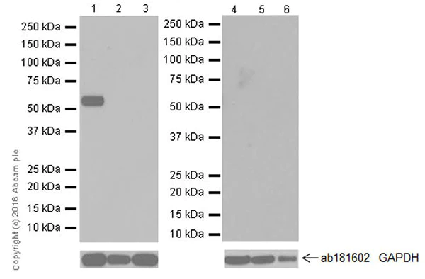 Western blot - Anti-Salivary alpha amylase antibody [EPR19605] (AB201450)