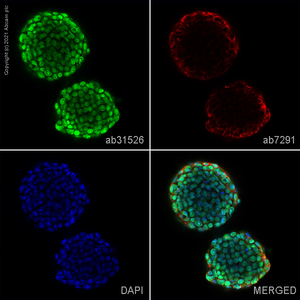 Immunocytochemistry/ Immunofluorescence - Anti-SALL1 antibody (AB31526)