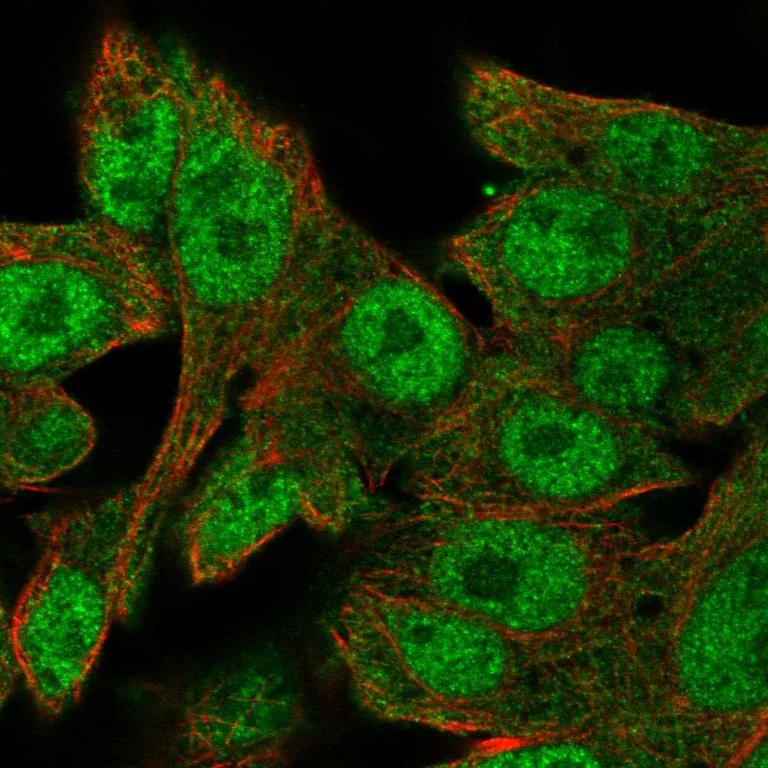 Immunocytochemistry/ Immunofluorescence - Anti-SALL1 Antibody (AB327235)