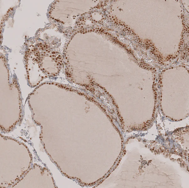 Immunohistochemistry (Formalin/PFA-fixed paraffin-embedded sections) - Anti-SALL1 Antibody (AB327235)