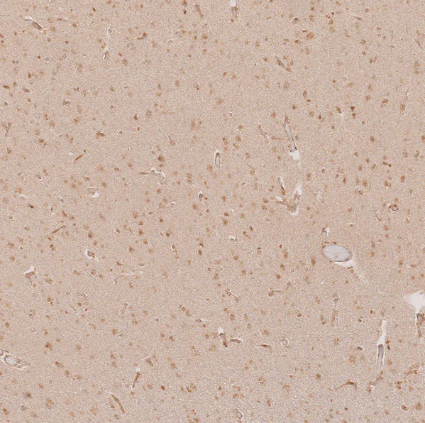 Immunohistochemistry (Formalin/PFA-fixed paraffin-embedded sections) - Anti-SALL1 Antibody (AB327235)