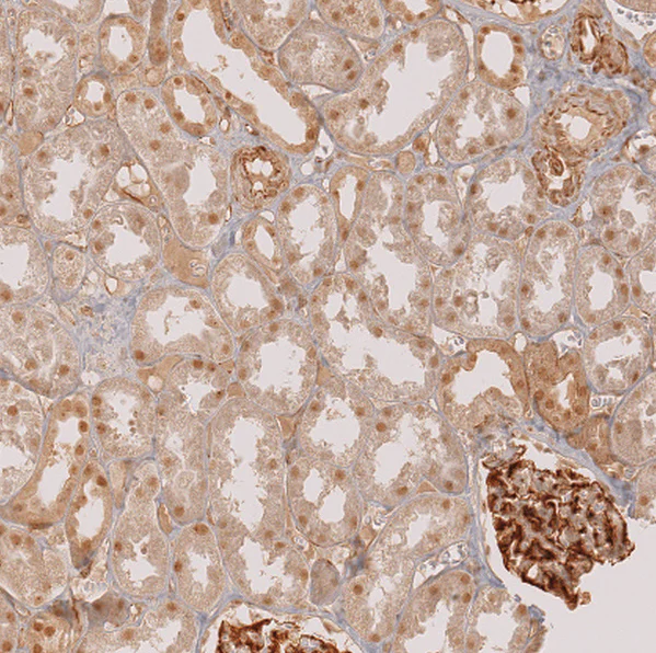 Immunohistochemistry (Formalin/PFA-fixed paraffin-embedded sections) - Anti-SALL1 Antibody (AB327235)