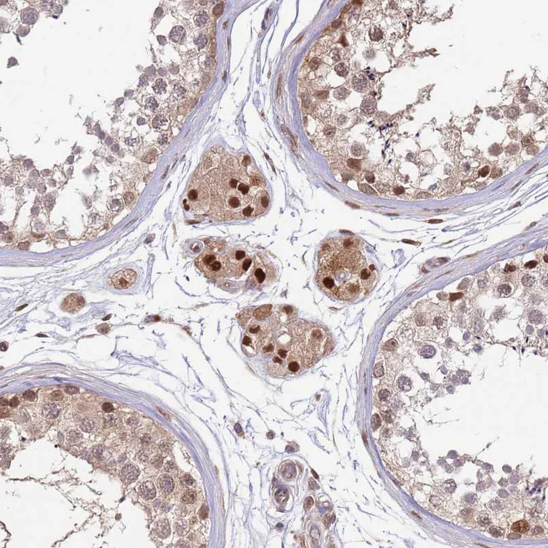 Immunohistochemistry (Formalin/PFA-fixed paraffin-embedded sections) - Anti-SALL1 Antibody (AB327235)