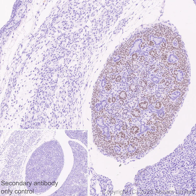 Immunohistochemistry (Formalin/PFA-fixed paraffin-embedded sections) - Anti-SALL1 antibody [EPR28911-52] (AB325098)