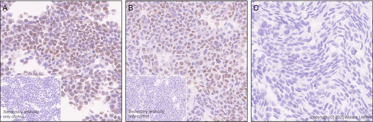 Immunohistochemistry (Formalin/PFA-fixed paraffin-embedded sections) - Anti-SALL1 antibody [EPR28911-52] (AB325098)
