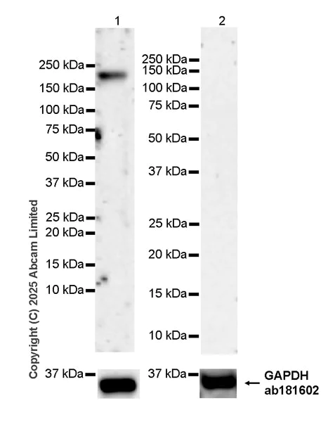 Western blot - Anti-SALL1 antibody [EPR28911-52] (AB325098)