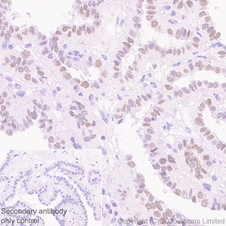 Immunohistochemistry (Formalin/PFA-fixed paraffin-embedded sections) - Anti-SALL1 antibody [EPR28911-52] - BSA and Azide free (AB325099)