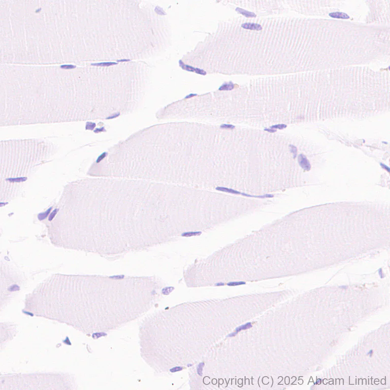 Immunohistochemistry (Formalin/PFA-fixed paraffin-embedded sections) - Anti-SALL1 antibody [EPR28911-52] - BSA and Azide free (AB325099)