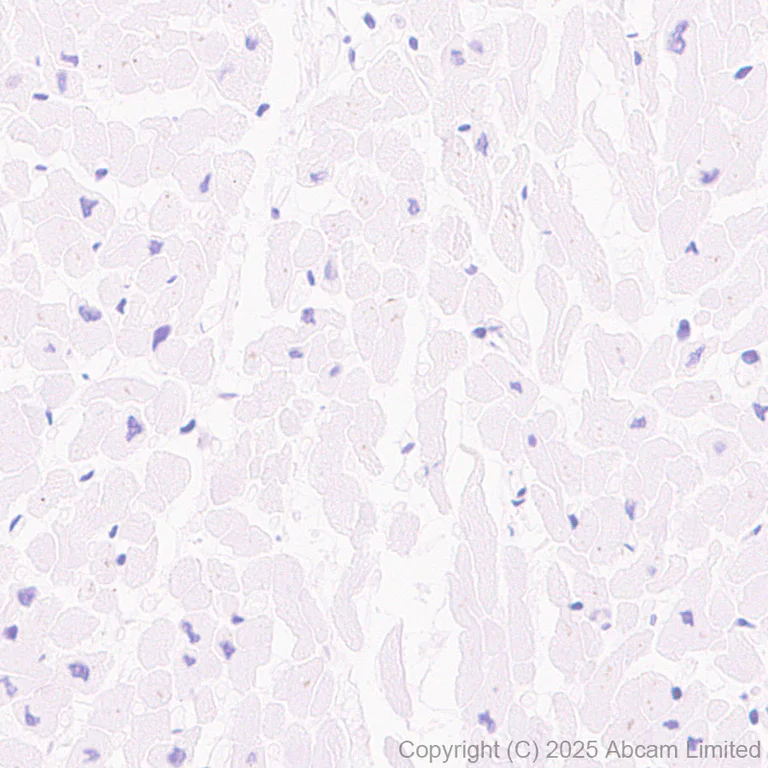 Immunohistochemistry (Formalin/PFA-fixed paraffin-embedded sections) - Anti-SALL1 antibody [EPR28911-52] - BSA and Azide free (AB325099)
