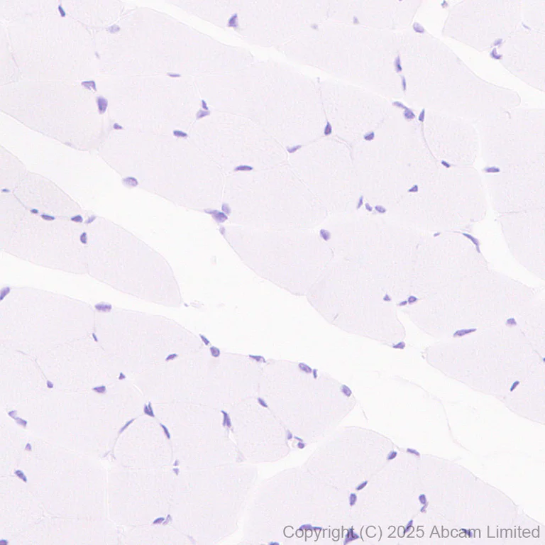 Immunohistochemistry (Formalin/PFA-fixed paraffin-embedded sections) - Anti-SALL1 antibody [EPR28911-52] - BSA and Azide free (AB325099)