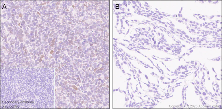Immunohistochemistry (Formalin/PFA-fixed paraffin-embedded sections) - Anti-SALL1 antibody [EPR28911-52] - BSA and Azide free (AB325099)