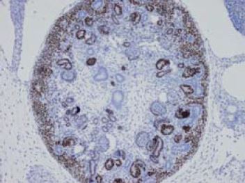 Immunohistochemistry (Formalin/PFA-fixed paraffin-embedded sections) - Anti-SALL1 antibody [K9814] (AB41974), expandable thumbnail