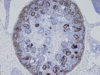 Immunohistochemistry (Formalin/PFA-fixed paraffin-embedded sections) - Anti-SALL1 antibody [K9814] (AB41974)