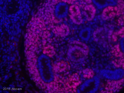 Immunohistochemistry (Formalin/PFA-fixed paraffin-embedded sections) - Anti-SALL1 antibody [K9814] (AB41974), expandable thumbnail