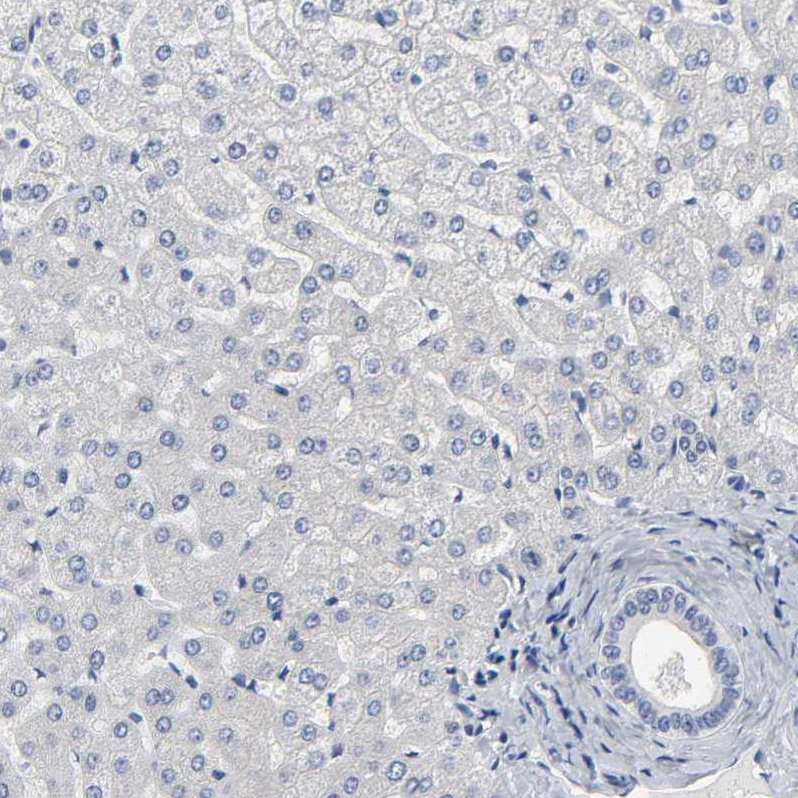 Immunohistochemistry (Formalin/PFA-fixed paraffin-embedded sections) - Anti-SALL2 antibody (AB244275)