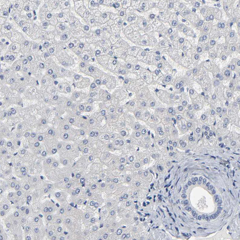 Immunohistochemistry (Formalin/PFA-fixed paraffin-embedded sections) - Anti-SALL2 antibody (AB244275)
