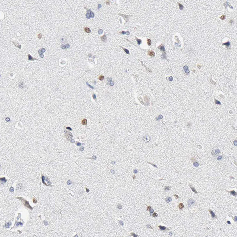 Immunohistochemistry (Formalin/PFA-fixed paraffin-embedded sections) - Anti-SALL2 antibody (AB244275)