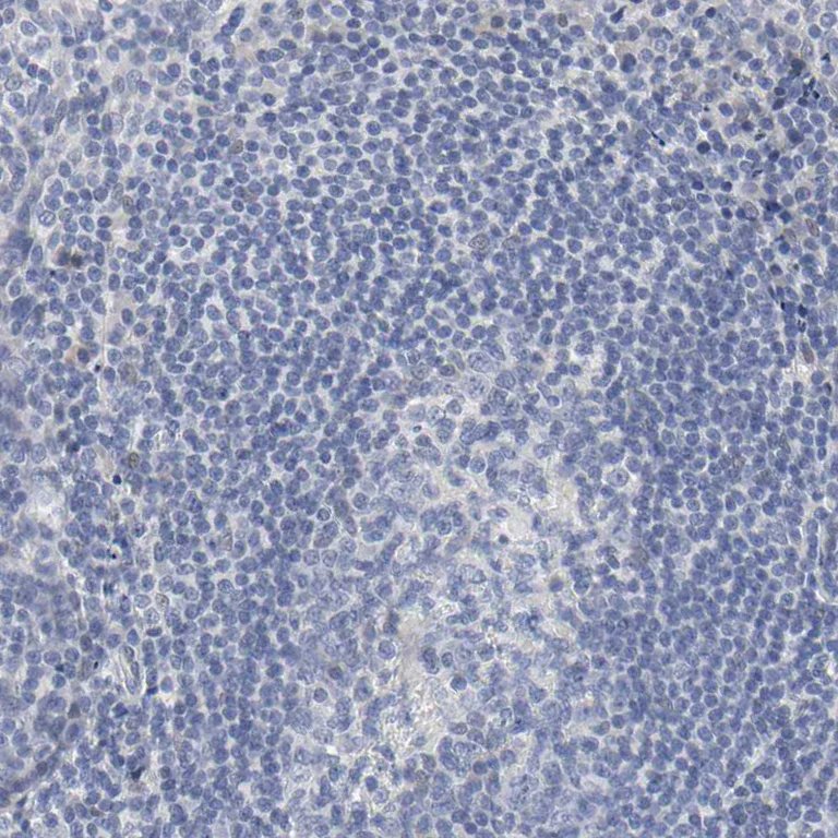 Immunohistochemistry (Formalin/PFA-fixed paraffin-embedded sections) - Anti-SALL2 antibody (AB244275)