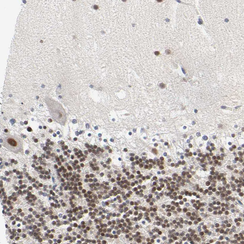 Immunohistochemistry (Formalin/PFA-fixed paraffin-embedded sections) - Anti-SALL2 antibody (AB244275)
