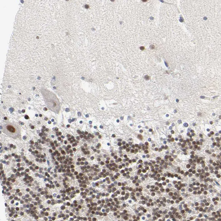 Immunohistochemistry (Formalin/PFA-fixed paraffin-embedded sections) - Anti-SALL2 antibody (AB244275)