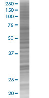 SALL2 overexpression 293T lysate (whole cell)