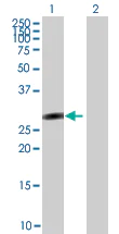 Western blot - SALL2 overexpression 293T lysate (whole cell) (AB94229)