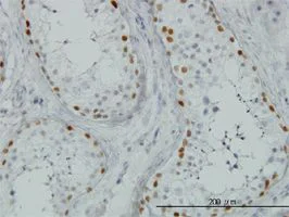 Immunohistochemistry (Formalin/PFA-fixed paraffin-embedded sections) - Anti-Sall4 antibody [6E3] (AB57577)