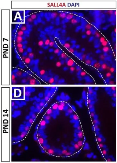 Immunohistochemistry (Formalin/PFA-fixed paraffin-embedded sections) - Anti-Sall4 antibody [6E3] (AB57577)