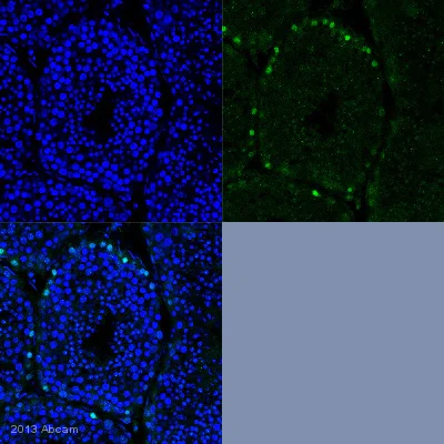 Immunohistochemistry (Formalin/PFA-fixed paraffin-embedded sections) - Anti-Sall4 antibody [6E3] (AB57577)