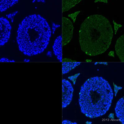 Immunohistochemistry (Formalin/PFA-fixed paraffin-embedded sections) - Anti-Sall4 antibody [6E3] (AB57577)