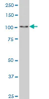 Western blot - Anti-Sall4 antibody [6E3] (AB57577)