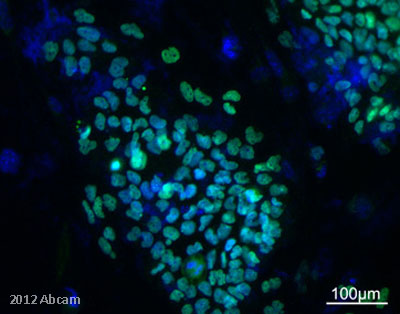 Immunocytochemistry/ Immunofluorescence - Anti-Sall4 antibody (AB29112), expandable thumbnail