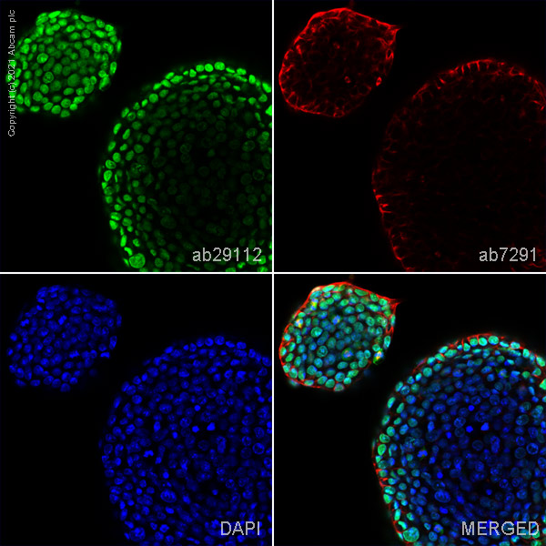Immunocytochemistry/ Immunofluorescence - Anti-Sall4 antibody (AB29112), expandable thumbnail