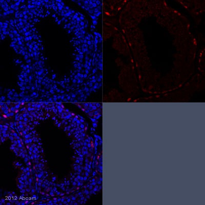 Immunohistochemistry (Formalin/PFA-fixed paraffin-embedded sections) - Anti-Sall4 antibody (ab29112), expandable thumbnail