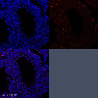 Immunohistochemistry (Formalin/PFA-fixed paraffin-embedded sections) - Anti-Sall4 antibody (AB29112)